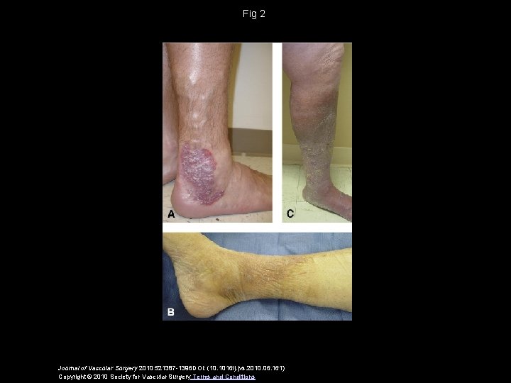 Fig 2 Journal of Vascular Surgery 2010 521387 -1396 DOI: (10. 1016/j. jvs. 2010.