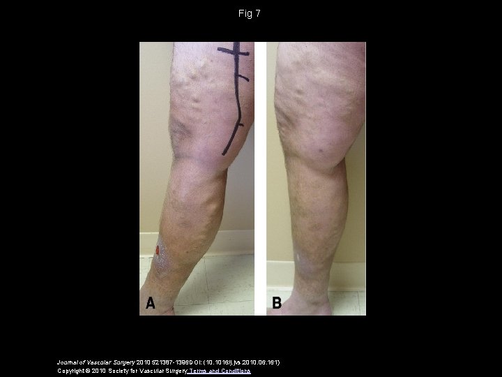 Fig 7 Journal of Vascular Surgery 2010 521387 -1396 DOI: (10. 1016/j. jvs. 2010.