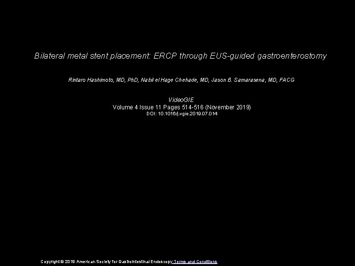 Bilateral metal stent placement: ERCP through EUS-guided gastroenterostomy Rintaro Hashimoto, MD, Ph. D, Nabil
