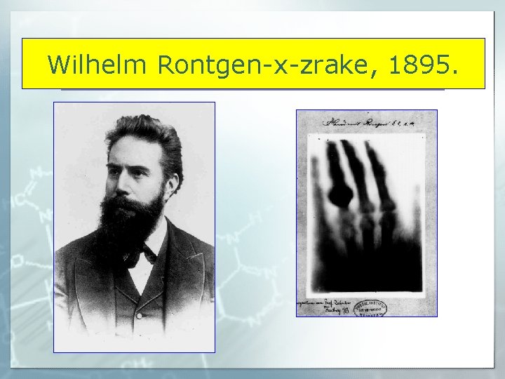 Wilhelm Rontgen-x-zrake, 1895. 