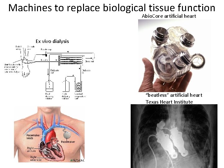 Machines to replace biological tissue function Abio. Core artificial heart Ex vivo dialysis “beatless”