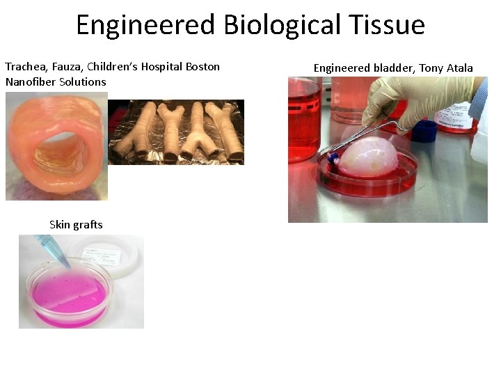 Engineered Biological Tissue Trachea, Fauza, Children’s Hospital Boston Nanofiber Solutions Skin grafts Engineered bladder,