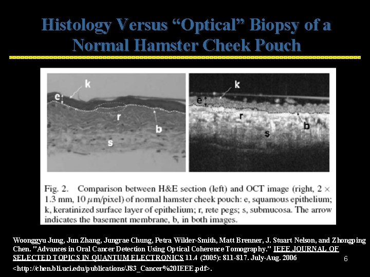 Histology Versus “Optical” Biopsy of a Normal Hamster Cheek Pouch Woonggyu Jung, Jun Zhang,
