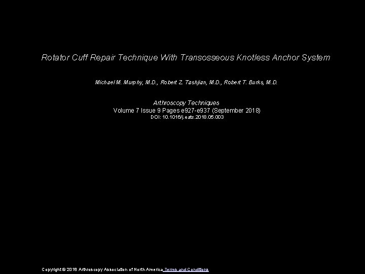 Rotator Cuff Repair Technique With Transosseous Knotless Anchor System Michael M. Murphy, M. D.