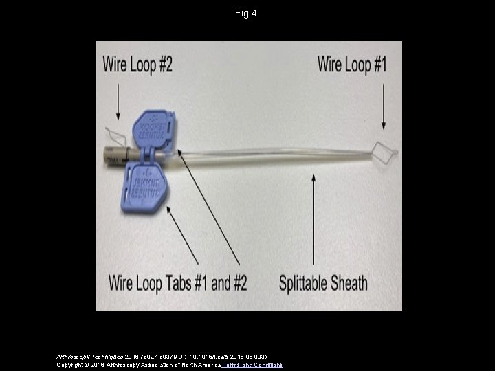 Fig 4 Arthroscopy Techniques 2018 7 e 927 -e 937 DOI: (10. 1016/j. eats.