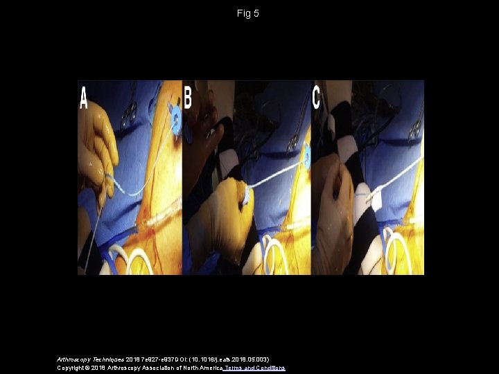 Fig 5 Arthroscopy Techniques 2018 7 e 927 -e 937 DOI: (10. 1016/j. eats.