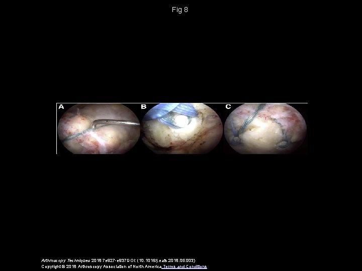 Fig 8 Arthroscopy Techniques 2018 7 e 927 -e 937 DOI: (10. 1016/j. eats.