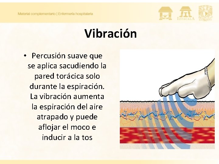 Vibración • Percusión suave que se aplica sacudiendo la pared torácica solo durante la Vibración • Percusión suave que se aplica sacudiendo la pared torácica solo durante la