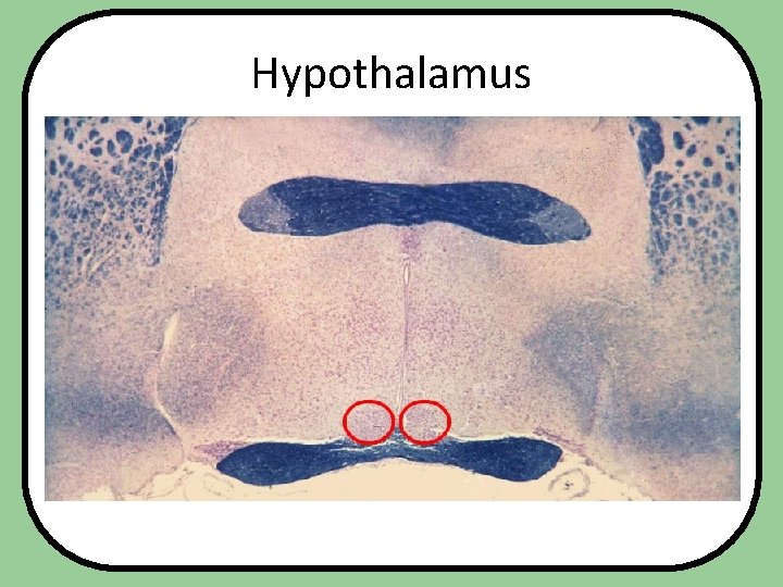 Hypothalamus 