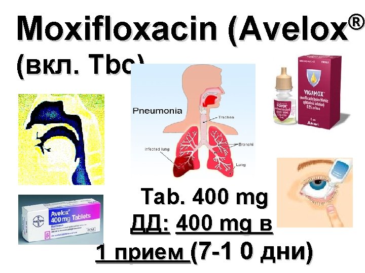 Moxifloxacin ® (Avelox ) (вкл. Tbc) Tab. 400 mg ДД: 400 mg в 1