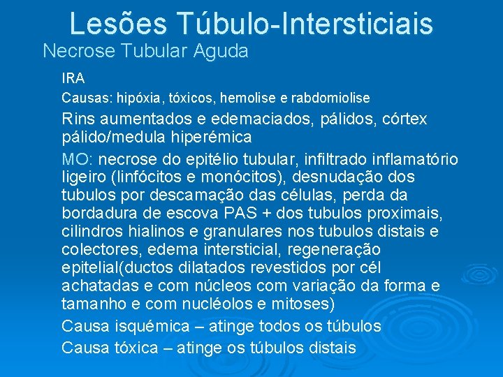 Lesões Túbulo-Intersticiais Necrose Tubular Aguda IRA Causas: hipóxia, tóxicos, hemolise e rabdomiolise Rins aumentados Lesões Túbulo-Intersticiais Necrose Tubular Aguda IRA Causas: hipóxia, tóxicos, hemolise e rabdomiolise Rins aumentados
