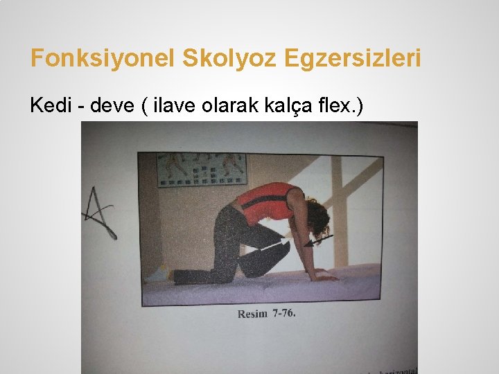 Fonksiyonel Skolyoz Egzersizleri Kedi - deve ( ilave olarak kalça flex. ) 