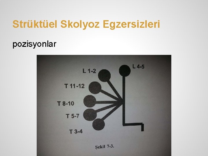 Strüktüel Skolyoz Egzersizleri pozisyonlar 