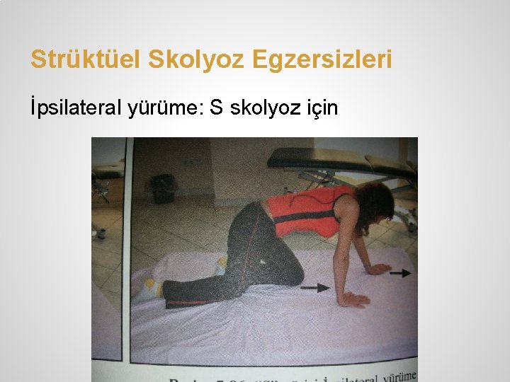 Strüktüel Skolyoz Egzersizleri İpsilateral yürüme: S skolyoz için 