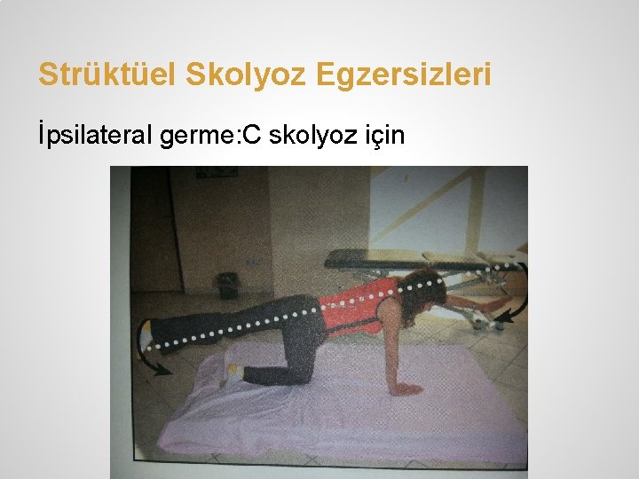 Strüktüel Skolyoz Egzersizleri İpsilateral germe: C skolyoz için 