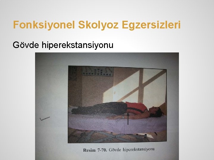 Fonksiyonel Skolyoz Egzersizleri Gövde hiperekstansiyonu 