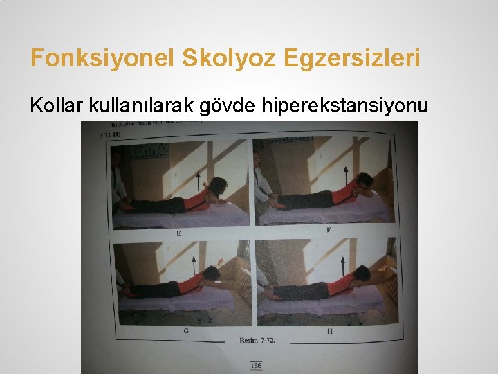 Fonksiyonel Skolyoz Egzersizleri Kollar kullanılarak gövde hiperekstansiyonu 