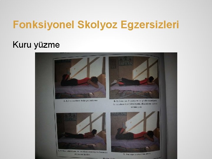 Fonksiyonel Skolyoz Egzersizleri Kuru yüzme 