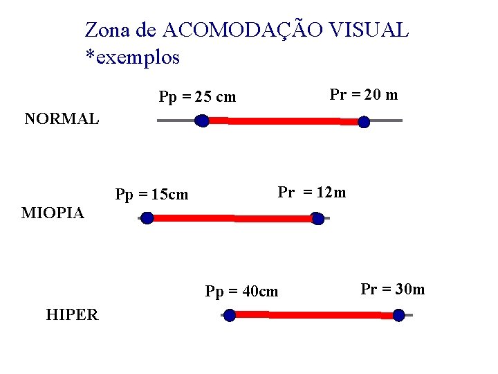 Zona de ACOMODAÇÃO VISUAL *exemplos Pr = 20 m Pp = 25 cm NORMAL