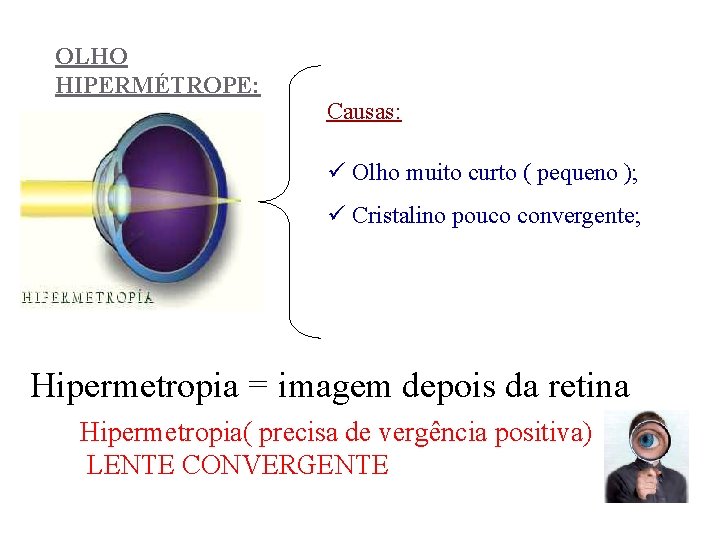 OLHO HIPERMÉTROPE: Causas: ü Olho muito curto ( pequeno ); ü Cristalino pouco convergente;