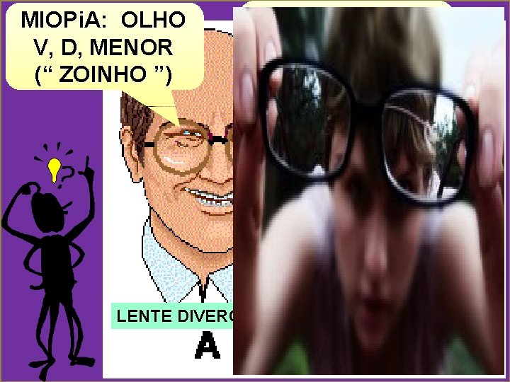 MIOPi. A: OLHO V, D, MENOR (“ ZOINHO ”) HIPERM. : OLHO V, D,