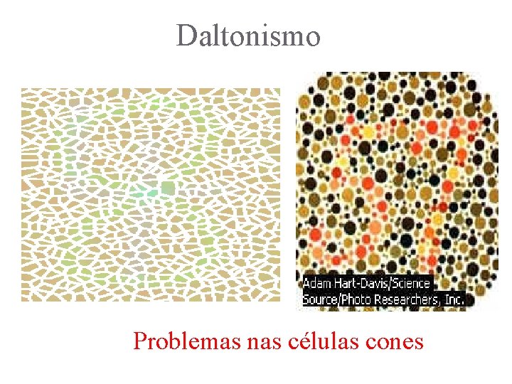 Daltonismo Problemas nas células cones 