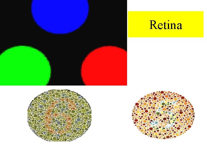 Retina 