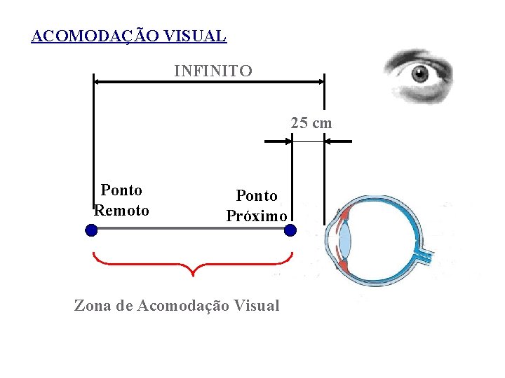 ACOMODAÇÃO VISUAL INFINITO 25 cm Ponto Remoto Ponto Próximo Zona de Acomodação Visual 