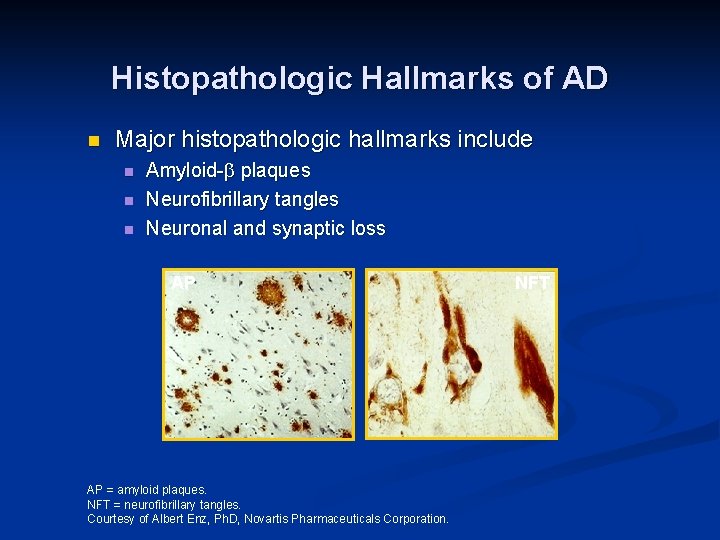 Histopathologic Hallmarks of AD n Major histopathologic hallmarks include n n n Amyloid- plaques