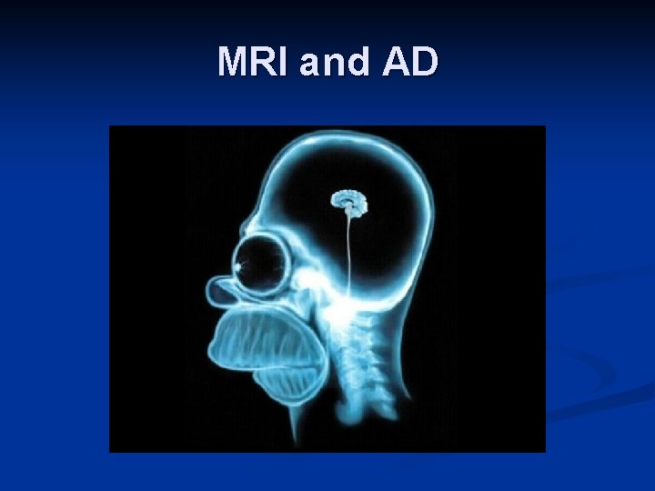 MRI and AD 