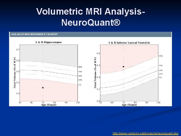 Volumetric MRI Analysis. Neuro. Quant® http: //www. cortechs. net/products/neuroquant. php 