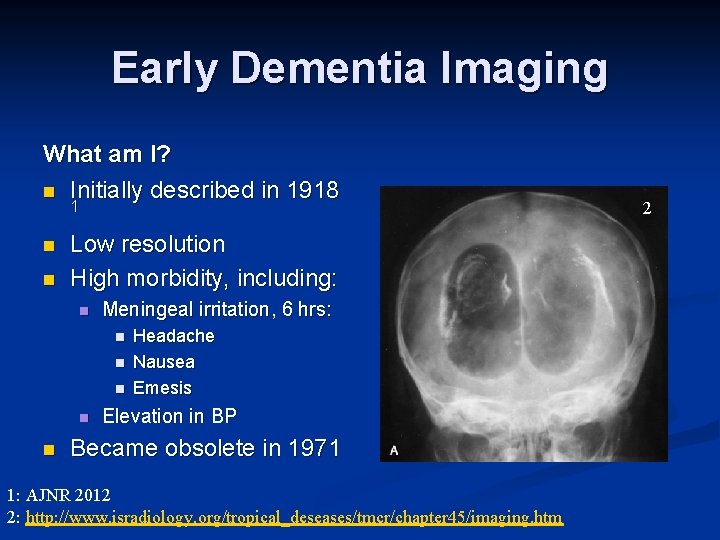 Early Dementia Imaging What am I? n Initially described in 1918 1 n n