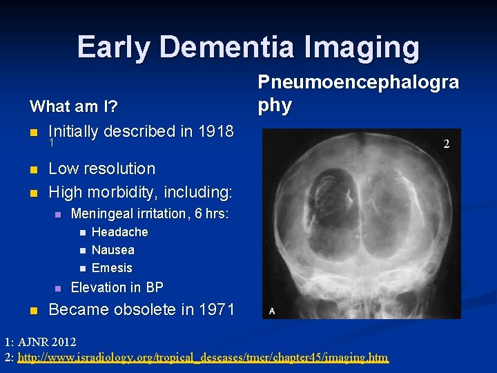 Early Dementia Imaging What am I? n Initially described in 1918 Pneumoencephalogra phy 1