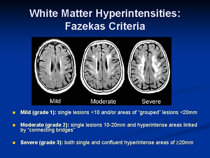 White Matter Hyperintensities: Fazekas Criteria n Mild (grade 1): single lesions <10 and/or areas