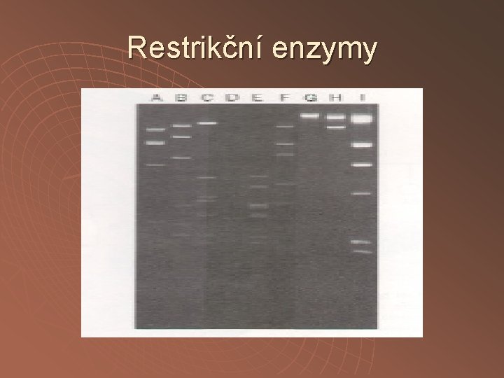 Restrikční enzymy 
