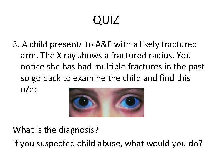 QUIZ 3. A child presents to A&E with a likely fractured arm. The X