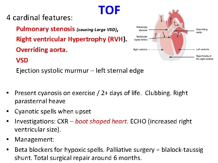 4 cardinal features: TOF Pulmonary stenosis (causing Large VSD), Right ventricular Hypertrophy (RVH). Overriding