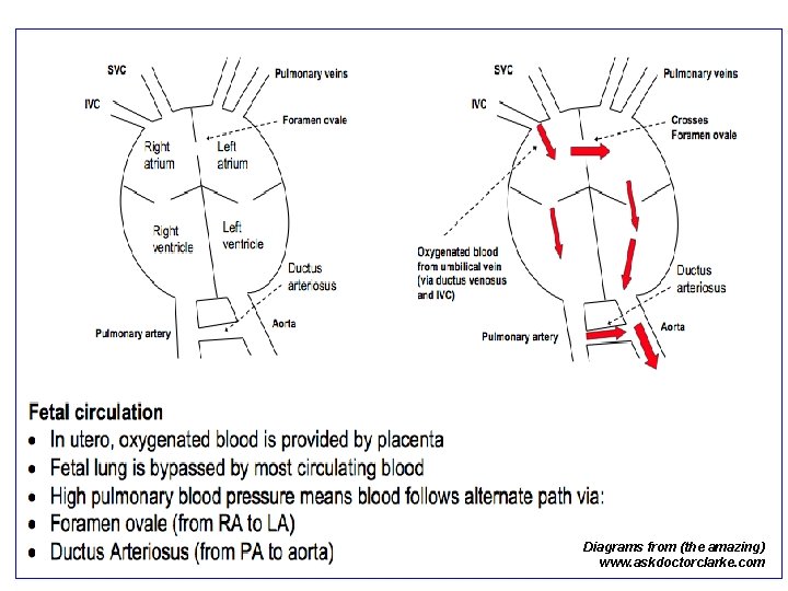 Diagrams from (the amazing) www. askdoctorclarke. com 