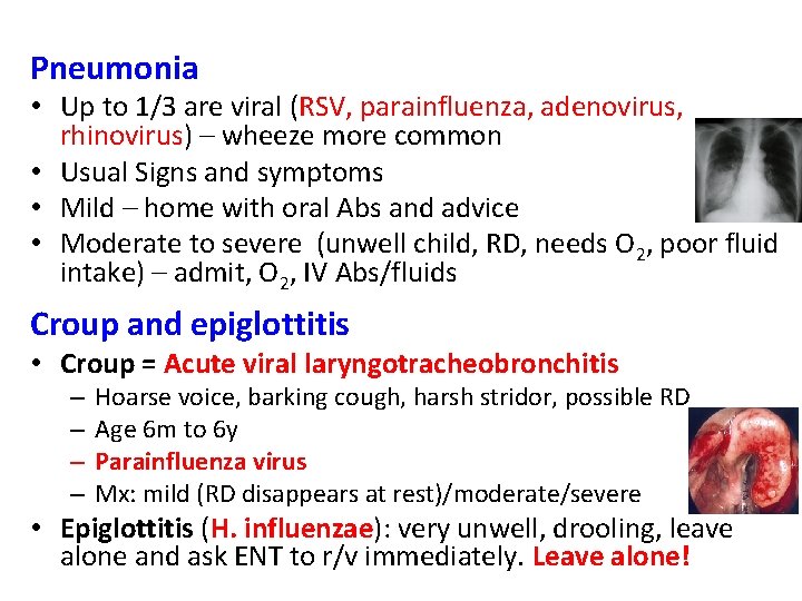 Pneumonia • Up to 1/3 are viral (RSV, parainfluenza, adenovirus, rhinovirus) – wheeze more