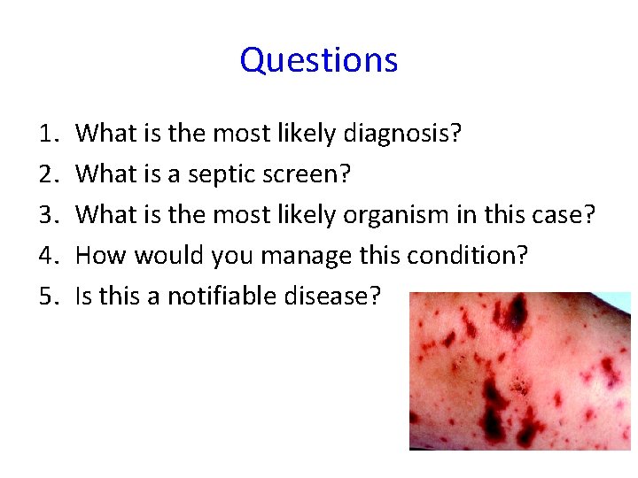 Questions 1. 2. 3. 4. 5. What is the most likely diagnosis? What is