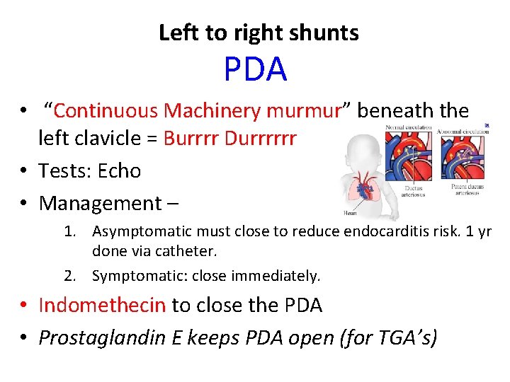 Left to right shunts PDA • “Continuous Machinery murmur” beneath the left clavicle =