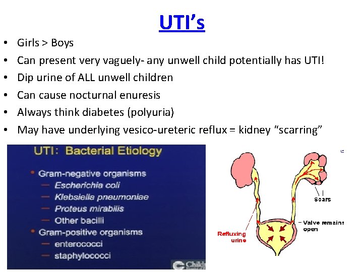 UTI’s • • • Girls > Boys Can present very vaguely- any unwell child