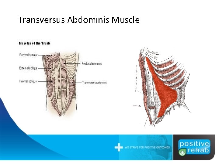 Transversus Abdominis Muscle 