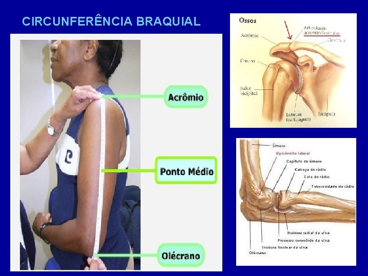 CIRCUNFERÊNCIA BRAQUIAL 