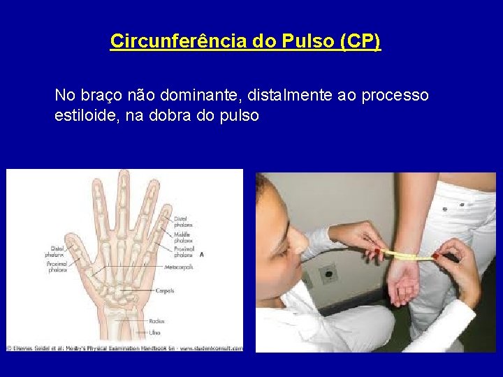 Circunferência do Pulso (CP) No braço não dominante, distalmente ao processo estiloide, na dobra