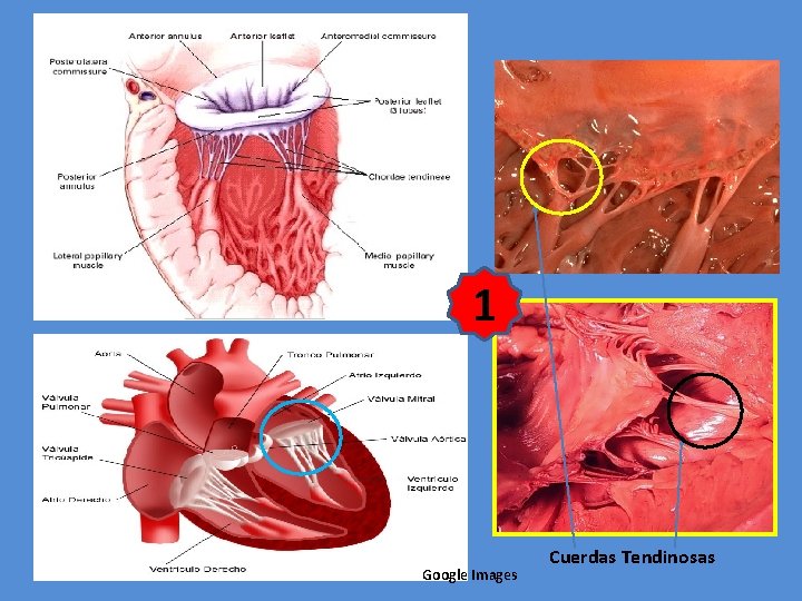 1 Google Images Cuerdas Tendinosas 