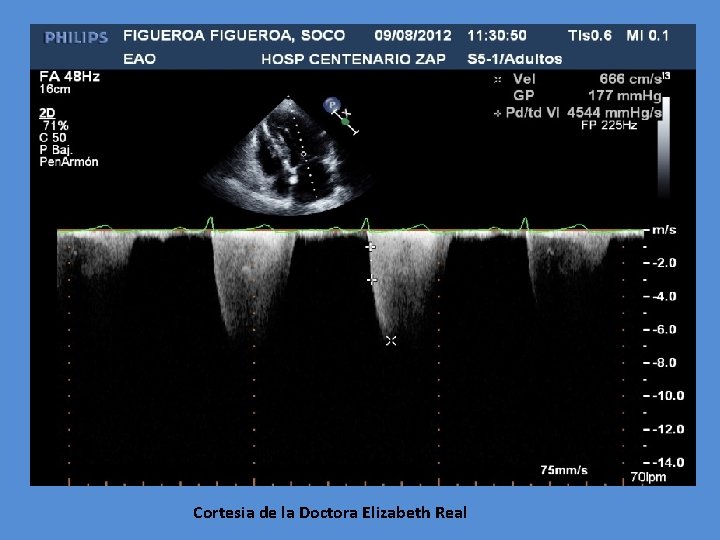 Cortesia de la Doctora Elizabeth Real 