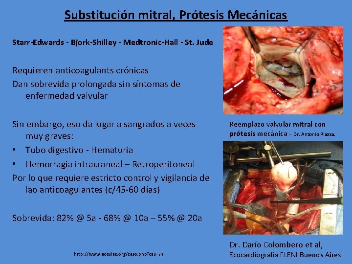 Substitución mitral, Prótesis Mecánicas Starr-Edwards - Bjork-Shilley - Medtronic-Hall - St. Jude Requieren anticoagulants