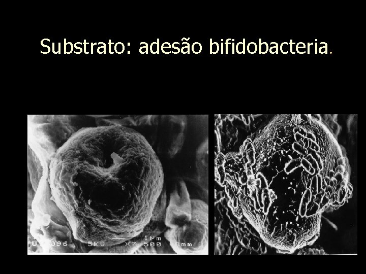 Substrato: adesão bifidobacteria. 