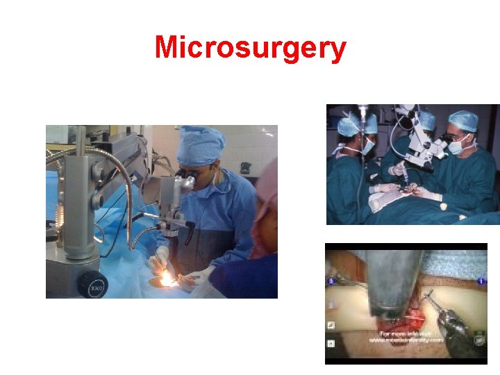 Microsurgery Microsurgery